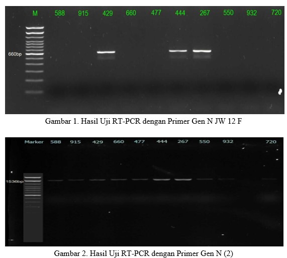 Deteksi Virus Rabies dengan Metode Rt-PCR (Reverse Transcriptase-Polymerase Chain Reaction) Menggunakan Dua Primer Yang Berbeda  