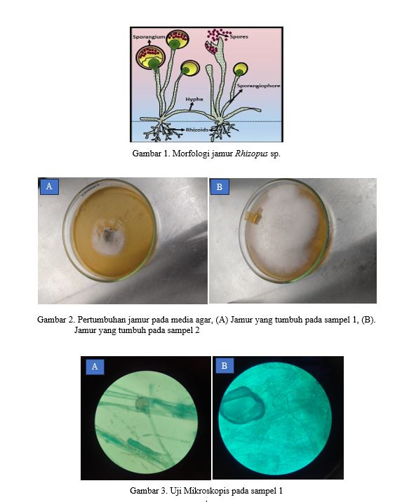 Uji Mikroskopis Jamur Rhizopus sp. Pengamatan Morfologi  dan Identifikasi